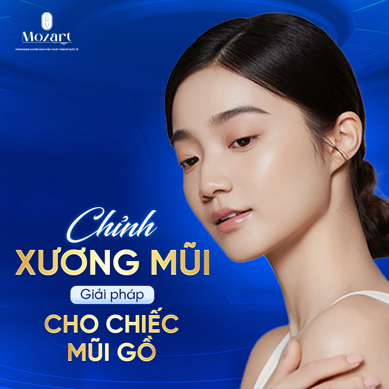 Chỉnh xương mũi gồ
