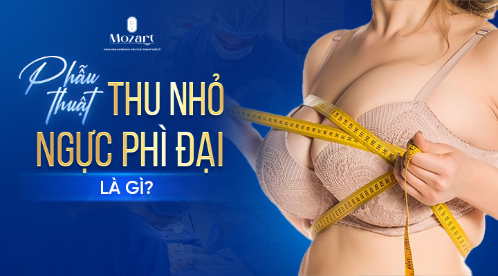thu nhỏ ngực phì đại