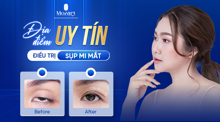 điều trị sụp mi mắt