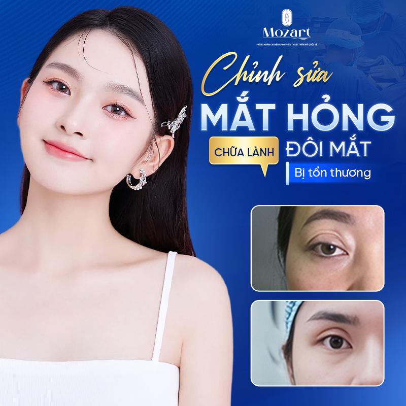 chỉnh sửa mắt hỏng