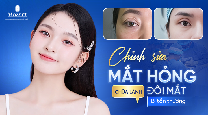 chỉnh sửa mắt hỏng