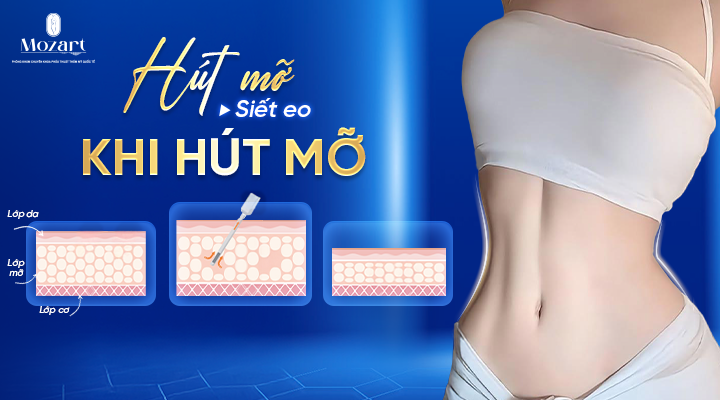 Hút mỡ siết eo