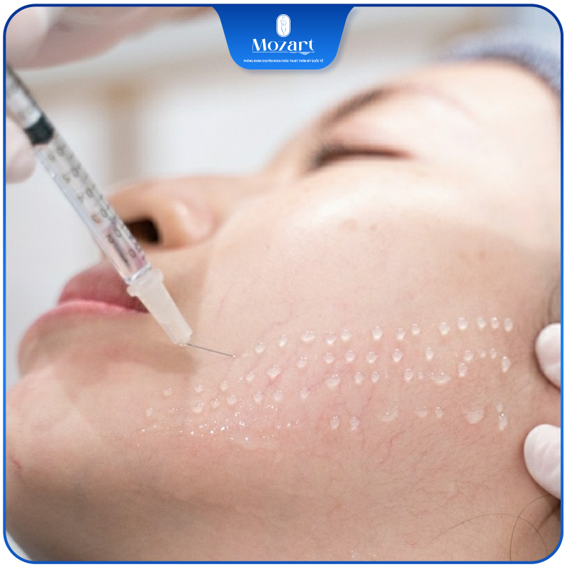 Mesotherapy