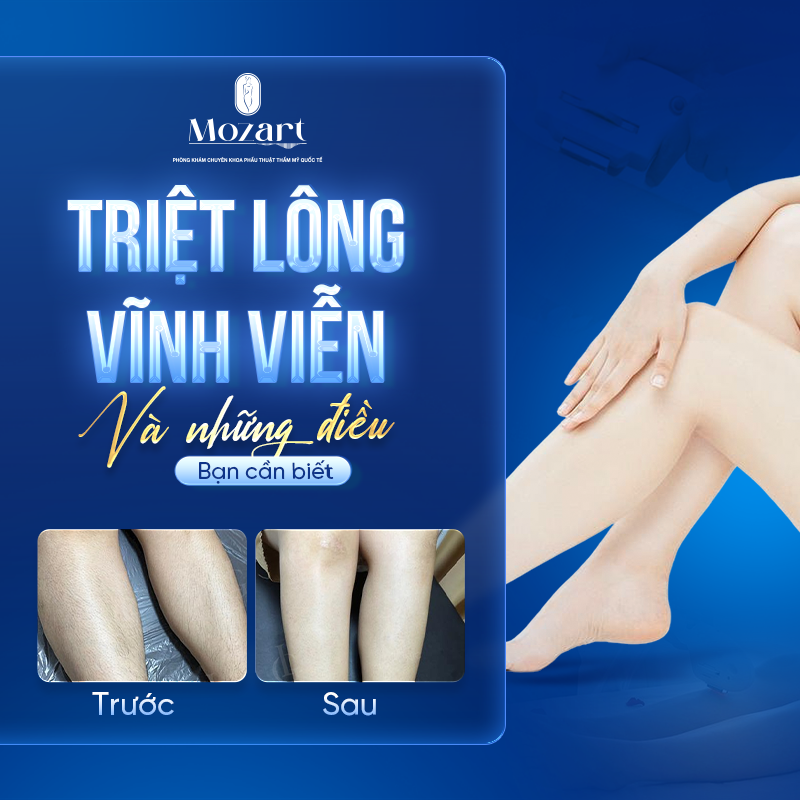triệt lông