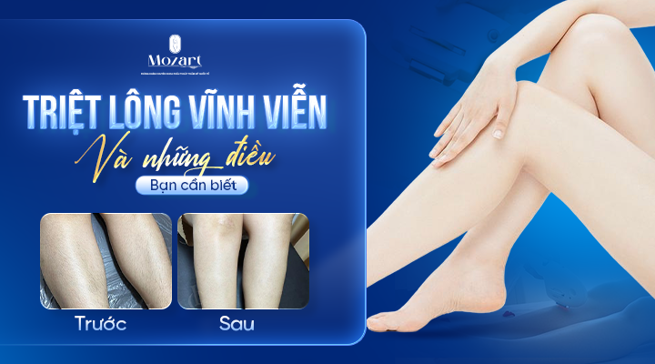 triệt lông