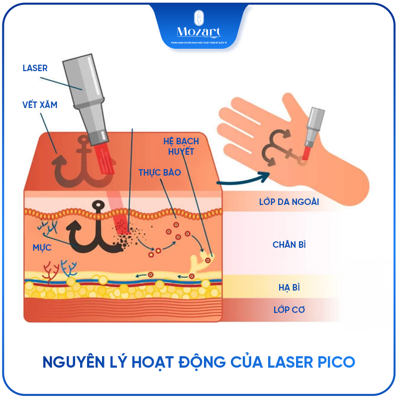 Laser Pico