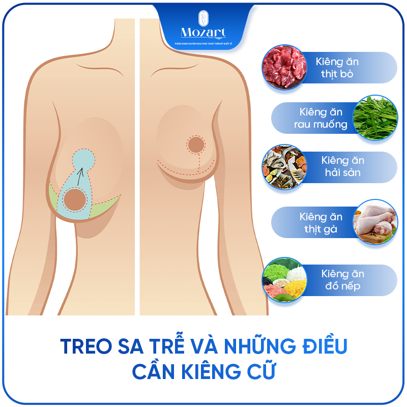thu nhỏ ngực phì đại