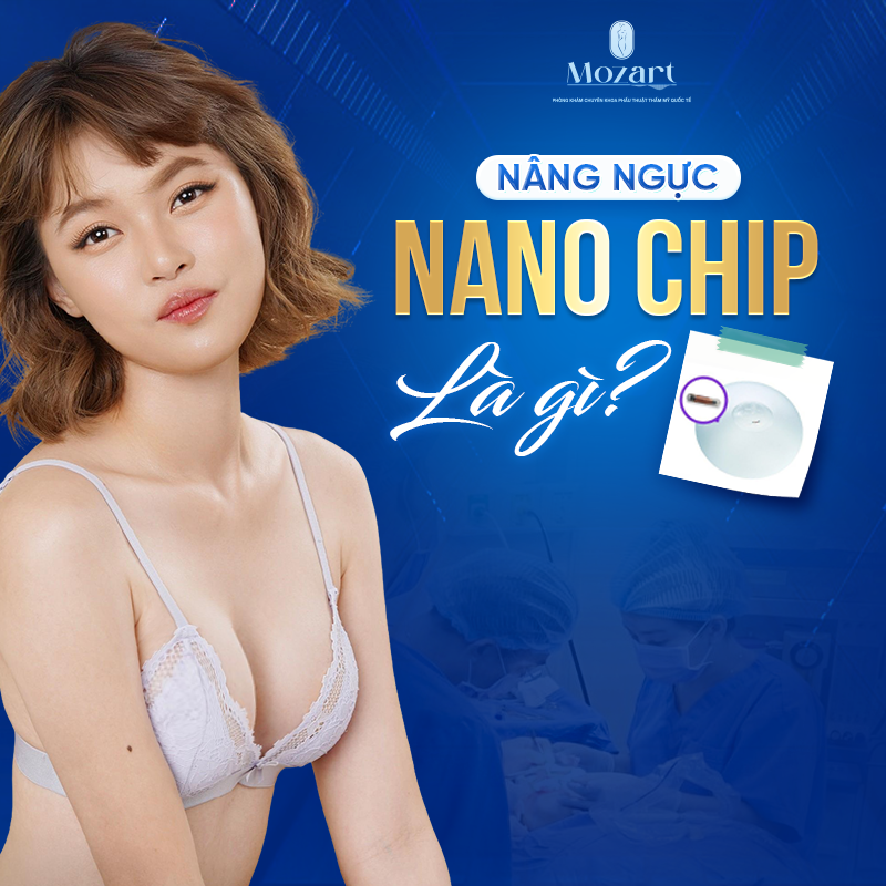 nâng ngực Nano Chip