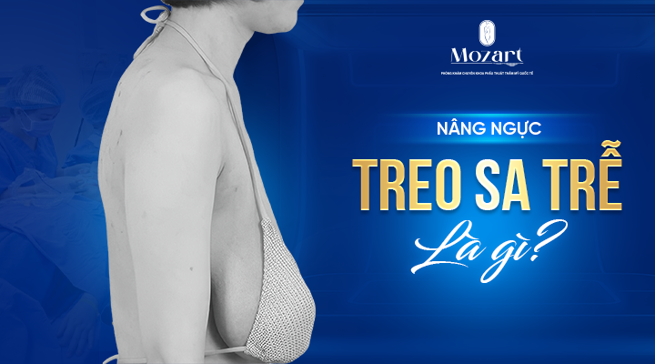 treo ngực sa trễ