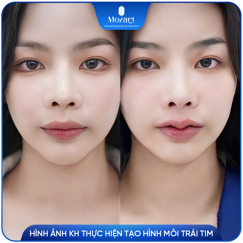 Tạo hình môi trái tim