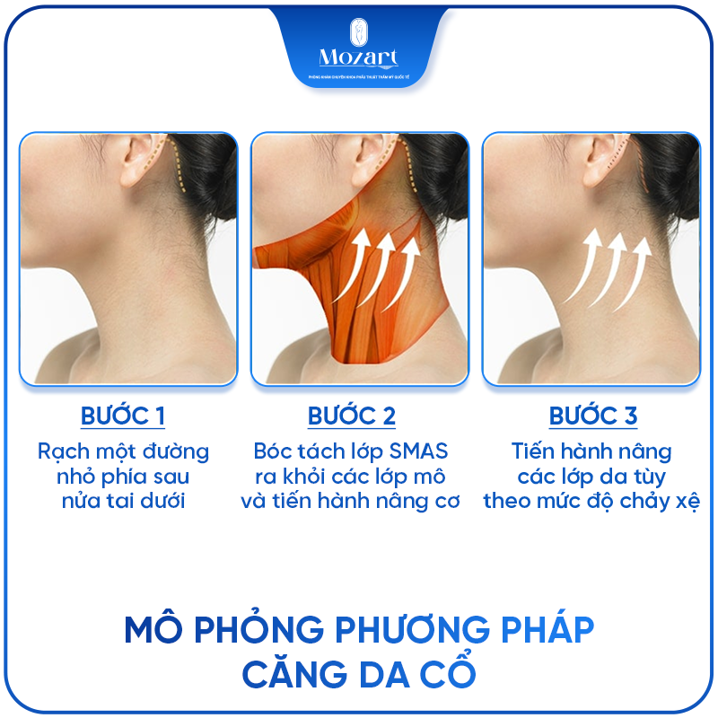 căng da cổ