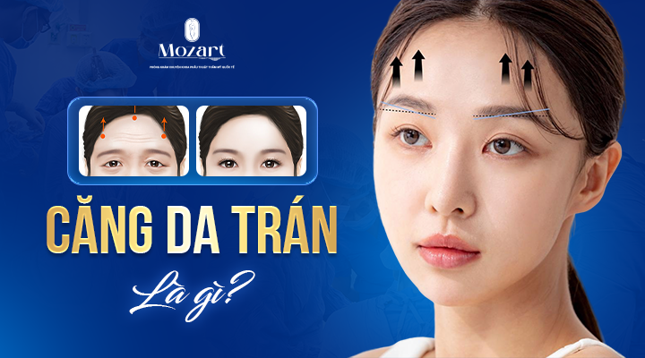 căng da trán