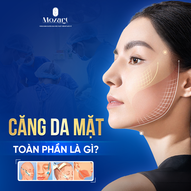 Căng da mặt toàn phần