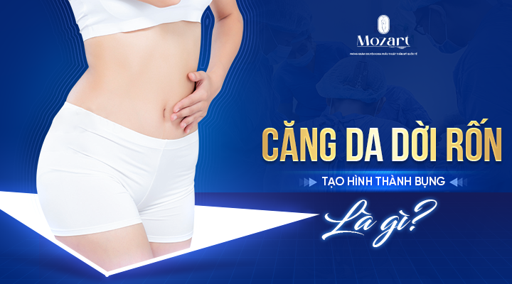 căng da bụng dời rốn tạo hình thành bụng