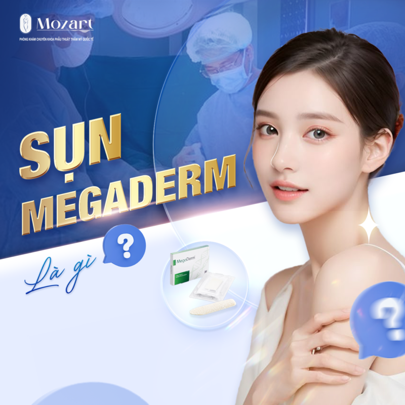 Sụn Megaderm