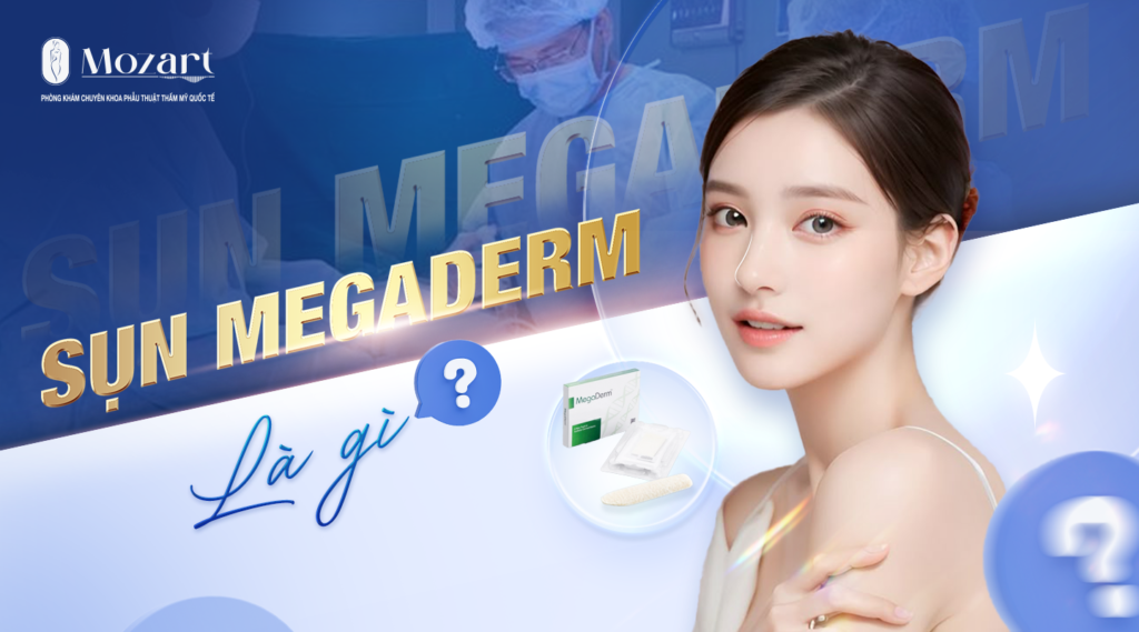 Sụn Megaderm