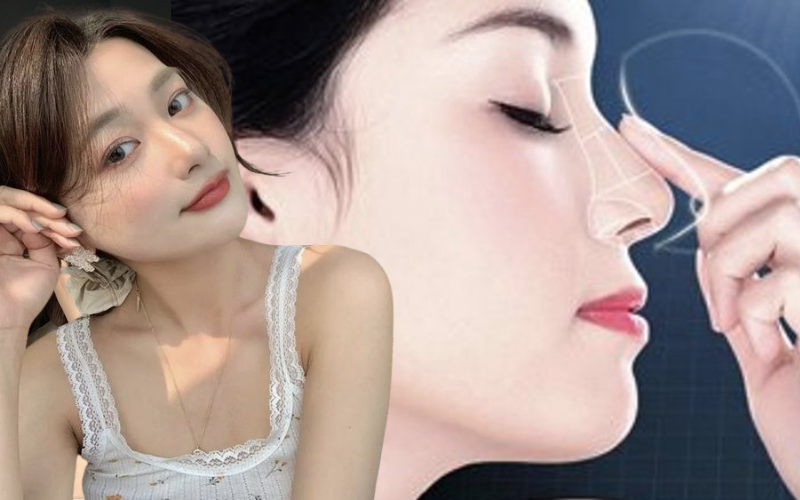 Sụn Surgiform